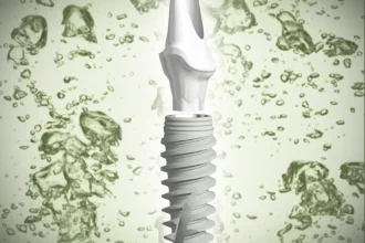 Ein computeranimiertes Zahnimplantat mit einem Gewinde